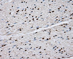 DAPK2 / DAP Kinase 2 Antibody - Immunohistochemical staining of paraffin-embedded colon tissue using anti-DAPK2 mouse monoclonal antibody. (Dilution 1:50).
