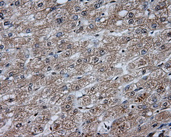 DAPK2 / DAP Kinase 2 Antibody - Immunohistochemical staining of paraffin-embedded liver tissue using anti-DAPK2 mouse monoclonal antibody. (Dilution 1:50).