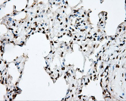 DAPK2 / DAP Kinase 2 Antibody - Immunohistochemical staining of paraffin-embedded lung tissue using anti-DAPK2 mouse monoclonal antibody. (Dilution 1:50).