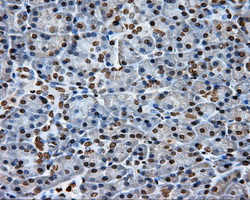 DAPK2 / DAP Kinase 2 Antibody - Immunohistochemical staining of paraffin-embedded pancreas tissue using anti-DAPK2 mouse monoclonal antibody. (Dilution 1:50).