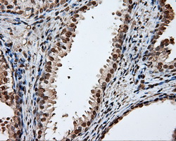 DAPK2 / DAP Kinase 2 Antibody - Immunohistochemical staining of paraffin-embedded prostate tissue using anti-DAPK2 mouse monoclonal antibody. (Dilution 1:50).