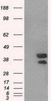 DAPK2 / DAP Kinase 2 Antibody - HEK293T cells were transfected with the pCMV6-ENTRY control (Left lane) or pCMV6-ENTRY DAPK2 (Right lane) cDNA for 48 hrs and lysed. Equivalent amounts of cell lysates (5 ug per lane) were separated by SDS-PAGE and immunoblotted with anti-DAPK2.