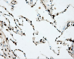 DAPK2 / DAP Kinase 2 Antibody - Immunohistochemical staining of paraffin-embedded lung tissue using anti-DAPK2 mouse monoclonal antibody. (Dilution 1:50).