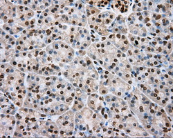 DAPK2 / DAP Kinase 2 Antibody - Immunohistochemical staining of paraffin-embedded pancreas tissue using anti-DAPK2 mouse monoclonal antibody. (Dilution 1:50).