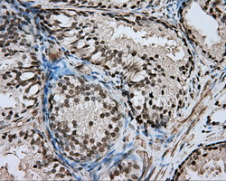 DAPK2 / DAP Kinase 2 Antibody - Immunohistochemical staining of paraffin-embedded prostate tissue using anti-DAPK2 mouse monoclonal antibody. (Dilution 1:50).