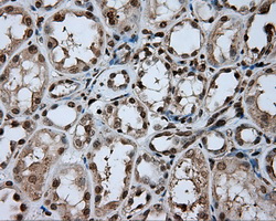 DAPK2 / DAP Kinase 2 Antibody - Immunohistochemical staining of paraffin-embedded Kidney tissue using anti-DAPK2 mouse monoclonal antibody. (Dilution 1:50).