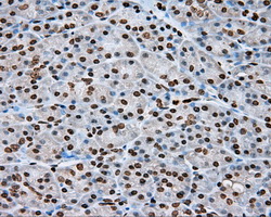 DAPK2 / DAP Kinase 2 Antibody - Immunohistochemical staining of paraffin-embedded pancreas tissue using anti-DAPK2 mouse monoclonal antibody. (Dilution 1:50).