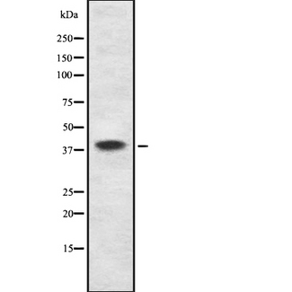 DAPK2 / DAP Kinase 2 Antibody - Western blot analysis of DAPK2 using K562 whole cells lysates