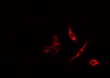 DAPK2 / DAP Kinase 2 Antibody - Staining HepG2 cells by IF/ICC. The samples were fixed with PFA and permeabilized in 0.1% Triton X-100, then blocked in 10% serum for 45 min at 25°C. The primary antibody was diluted at 1:200 and incubated with the sample for 1 hour at 37°C. An Alexa Fluor 594 conjugated goat anti-rabbit IgG (H+L) Ab, diluted at 1/600, was used as the secondary antibody.