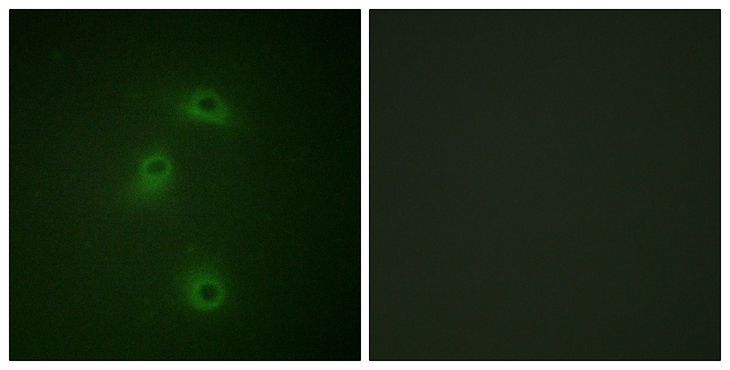 DAPK2 / DAP Kinase 2 Antibody - Immunofluorescence analysis of COS7 cells, using DAPK2 (Phospho-Ser318) Antibody. The picture on the right is blocked with the phospho peptide.