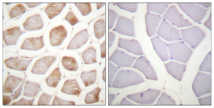 DAPK2 / DAP Kinase 2 Antibody - Immunohistochemistry analysis of paraffin-embedded human skeletal muscle, using DAPK2 (Phospho-Ser318) Antibody. The picture on the right is blocked with the phospho peptide.