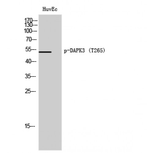 DAPK3 / ZIP Kinase Antibody - Western blot of Phospho-DAPK3 (T265) antibody