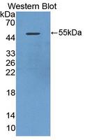 DAPK3 / ZIP Kinase Antibody - Western blot of DAPK3 / ZIP Kinase antibody.