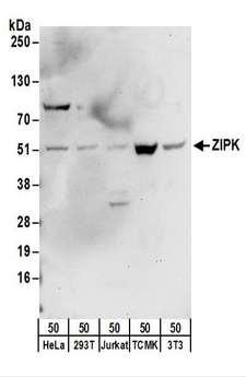 DAPK3 / ZIP Kinase Antibody - Detection of Human and Mouse ZIPK by Western Blot. Samples: Whole cell lysate (50 ug) from HeLa, 293T, Jurkat, mouse TCMK-1, and mouse NIH3T3 cells. Antibodies: Affinity purified rabbit anti-ZIPK antibody used for WB at 0.4 ug/ml. Detection: Chemiluminescence with an exposure time of 30 seconds.
