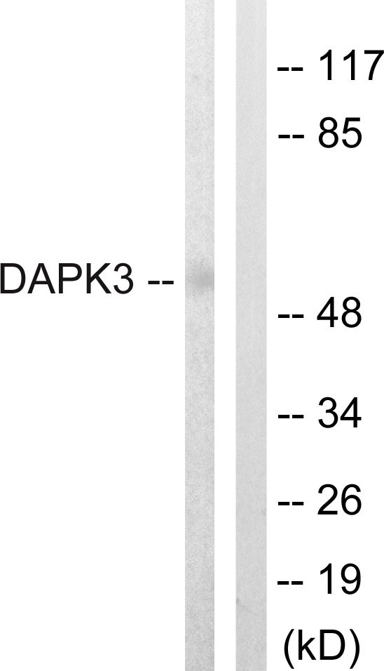 DAPK3 / ZIP Kinase Antibody - Western blot analysis of lysates from HUVEC cells, using DAPK3 Antibody. The lane on the right is blocked with the synthesized peptide.