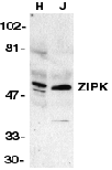 DAPK3 / ZIP Kinase Antibody - Western blot analysis of ZIP kinase in HeLa (H) and Jurkat (J) cell lysates with ZIP kinase antibody at 1 g/ml.