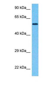 DAPK3 / ZIP Kinase Antibody - Western blot of DAPK3 Antibody with human 721_B Whole Cell lysate.  This image was taken for the unconjugated form of this product. Other forms have not been tested.