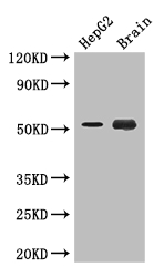 DAPK3 / ZIP Kinase Antibody - Positive WB detected in:HepG2 whole cell lysate,Mouse brain tissue;All lanes: DAPK3 antibody at 3.4ug/ml;Secondary;Goat polyclonal to rabbit IgG at 1/50000 dilution;Predicted band size: 53,38 kDa;Observed band size: 53 kDa;