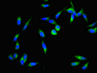 DAPK3 / ZIP Kinase Antibody - Immunofluorescent analysis of Hela cells using DAPK3 Antibody at dilution of 1:100 and Alexa Fluor 488-congugated AffiniPure Goat Anti-Rabbit IgG(H+L)