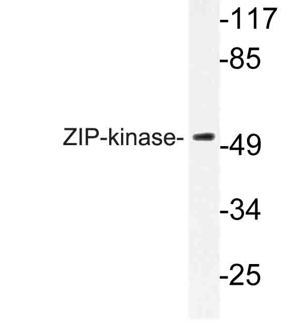 DAPK3 / ZIP Kinase Antibody - Western blot of ZIP-kinase (K261) pAb in extracts from HUVEC cells.