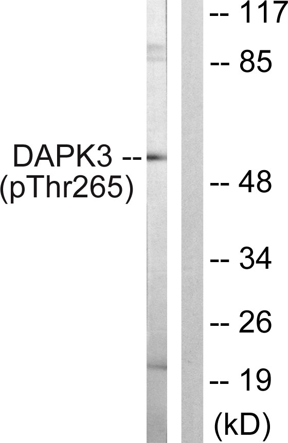 DAPK3 / ZIP Kinase Antibody - Western blot analysis of lysates from HUVEC cells, using DAPK3 (Phospho-Thr265) Antibody. The lane on the right is blocked with the phospho peptide.