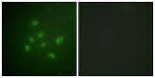 DAPK3 / ZIP Kinase Antibody - P-peptide - + Immunofluorescence analysis of A549 cells, using DAPK3 (Phospho-Thr265) antibody.