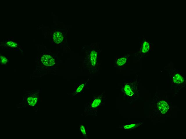 DAPK3 / ZIP Kinase Antibody - Immunofluorescence staining of DAPK3 in HeLa cells. Cells were fixed with 4% PFA, permeabilzed with 0.3% Triton X-100 in PBS, blocked with 10% serum, and incubated with rabbit anti-Human DAPK3 polyclonal antibody (dilution ratio 1:200) at 4°C overnight. Then cells were stained with the Alexa Fluor 488-conjugated Goat Anti-rabbit IgG secondary antibody (green). Positive staining was localized to Nucleus.