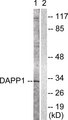 DAPP1 / BAM32 Antibody - Western blot analysis of lysates from 293 cells, treated with Insulin 0.01U/ml 2', using DAPP1 Antibody. The lane on the right is blocked with the synthesized peptide.