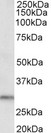 DAPP1 / BAM32 Antibody - Goat Anti-DAPP1 Antibody (0.5µg/ml) staining of Human Kidney lysate (35µg protein in RIPA buffer). Primary incubation was 1 hour. Detected by chemiluminescencence.