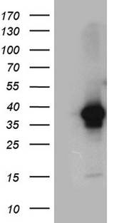 DAPP1 / BAM32 Antibody - HEK293T cells were transfected with the pCMV6-ENTRY control. (Left lane) or pCMV6-ENTRY DAPP1. (Right lane) cDNA for 48 hrs and lysed. Equivalent amounts of cell lysates. (5 ug per lane) were separated by SDS-PAGE and immunoblotted with anti-DAPP1. (1:2000)