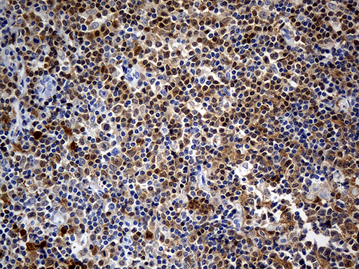 DAPP1 / BAM32 Antibody - Immunohistochemical staining of paraffin-embedded Human tonsil within the normal limits using anti-DAPP1 mouse monoclonal antibody. (Heat-induced epitope retrieval by 1mM EDTA in 10mM Tris buffer. (pH8.5) at 120°C for 3 min. (1:500)