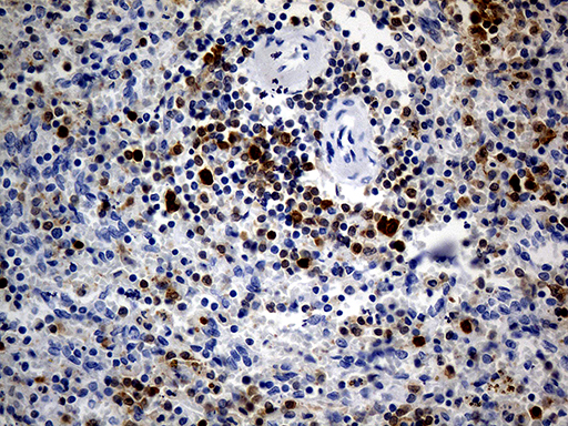 DAPP1 / BAM32 Antibody - Immunohistochemical staining of paraffin-embedded Human spleen tissue within the normal limits using anti-DAPP1 mouse monoclonal antibody. (Heat-induced epitope retrieval by Tris-EDTA(1:500)