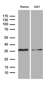 DAPP1 / BAM32 Antibody - Western blot analysis of extracts. (35ug) from 2 different cell lines by using anti-DAPP1 monoclonal antibody. (1:500)
