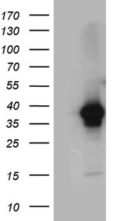 DAPP1 / BAM32 Antibody - HEK293T cells were transfected with the pCMV6-ENTRY control. (Left lane) or pCMV6-ENTRY DAPP1. (Right lane) cDNA for 48 hrs and lysed