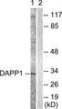 DAPP1 / BAM32 Antibody - Western blot analysis of extracts from 293 cells, treated with Insulin (0.01U/ml, 2mins), using DAPP1 (Ab-139) antibody.