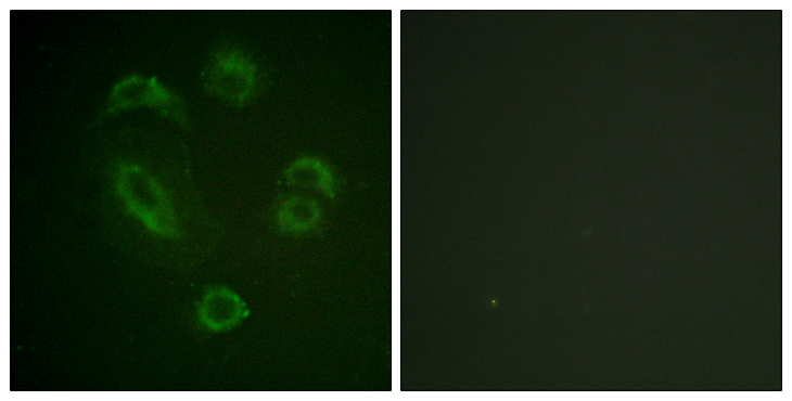 DAPP1 / BAM32 Antibody - Immunofluorescence analysis of A549 cells, using DAPP1 (Phospho-Tyr139) Antibody. The picture on the right is blocked with the phospho peptide.