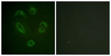 DAPP1 / BAM32 Antibody - Immunofluorescence analysis of A549 cells, using DAPP1 (Phospho-Tyr139) Antibody. The picture on the right is blocked with the phospho peptide.