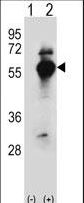 DARS Antibody - Western blot of DARS (arrow) using rabbit polyclonal DARS Antibody. 293 cell lysates (2 ug/lane) either nontransfected (Lane 1) or transiently transfected (Lane 2) with the DARS gene.