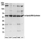 DARS Antibody - Detection of human and mouse Aspartyl-tRNA Synthetase by western blot. Samples: Whole cell lysate (50 µg) from HeLa, HEK293T, Jurkat, mouse TCMK-1, and mouse NIH 3T3 cells prepared using NETN lysis buffer. Antibody: Affinity purified rabbit anti-Aspartyl-tRNA Synthetase antibody used for WB at 0.1 µg/ml. Detection: Chemiluminescence with an exposure time of 3 minutes.