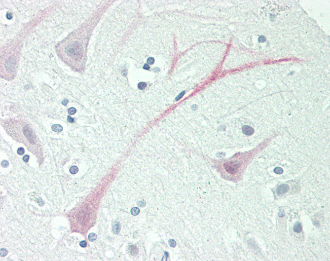 DARS Antibody - Human Brain, Cortex: Formalin-Fixed, Paraffin-Embedded (FFPE).  This image was taken for the unconjugated form of this product. Other forms have not been tested.