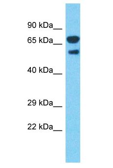 DARS Antibody - DARS antibody Western Blot of Human Fetal Lung . Antibody dilution: 1 ug/ml.  This image was taken for the unconjugated form of this product. Other forms have not been tested.
