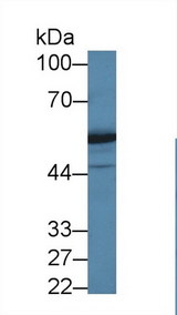 DARS Antibody