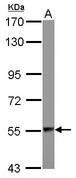 DARS Antibody - Sample (30 ug of whole cell lysate) A: IMR32 7.5% SDS PAGE DARS antibody diluted at 1:1000