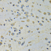 DARS Antibody - Immunohistochemistry of paraffin-embedded rat brain tissue.