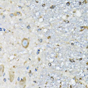 DARS Antibody - Immunohistochemistry of paraffin-embedded mouse spinal cord tissue.