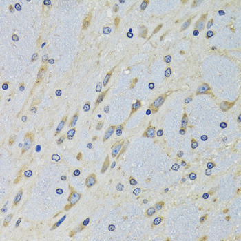 DARS Antibody - Immunohistochemistry of paraffin-embedded mouse brain tissue.