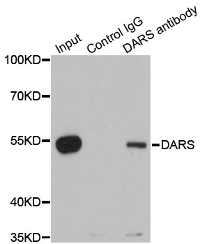 DARS Antibody - Immunoprecipitation analysis of 200ug extracts of 293T cells.