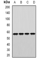 DARS Antibody - Western blot analysis of DARS expression in MCF7 (A); SW480 (B); mouse brain (C); rat liver (D) whole cell lysates.
