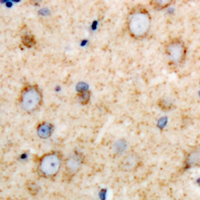DARS Antibody - Immunohistochemical analysis of DARS staining in rat brain formalin fixed paraffin embedded tissue section. The section was pre-treated using heat mediated antigen retrieval with sodium citrate buffer (pH 6.0). The section was then incubated with the antibody at room temperature and detected using an HRP conjugated compact polymer system. DAB was used as the chromogen. The section was then counterstained with hematoxylin and mounted with DPX.