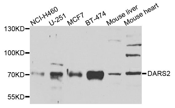 DARS2 Antibody - Western blot analysis of extracts of various cells.